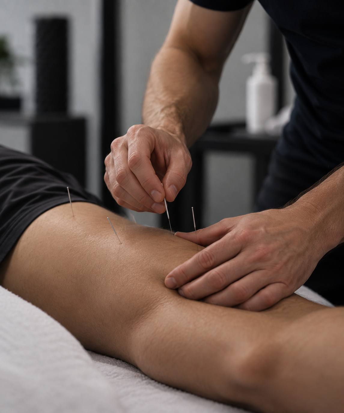 Dry needling treatment using fine needles in a targeted muscle area